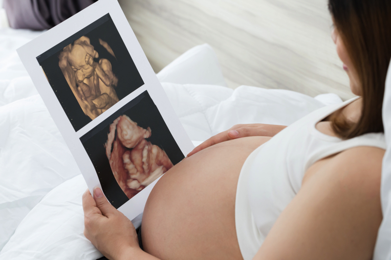 3D/4D Ultrasounds