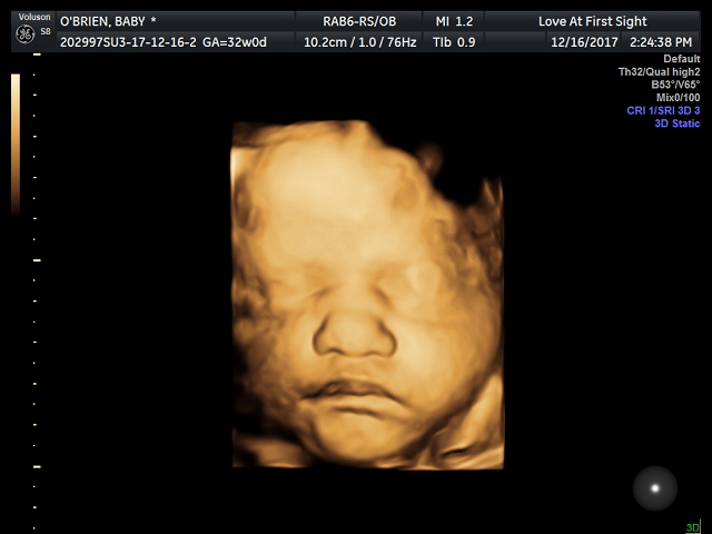 Ultrasound That Your Kids Can Attend