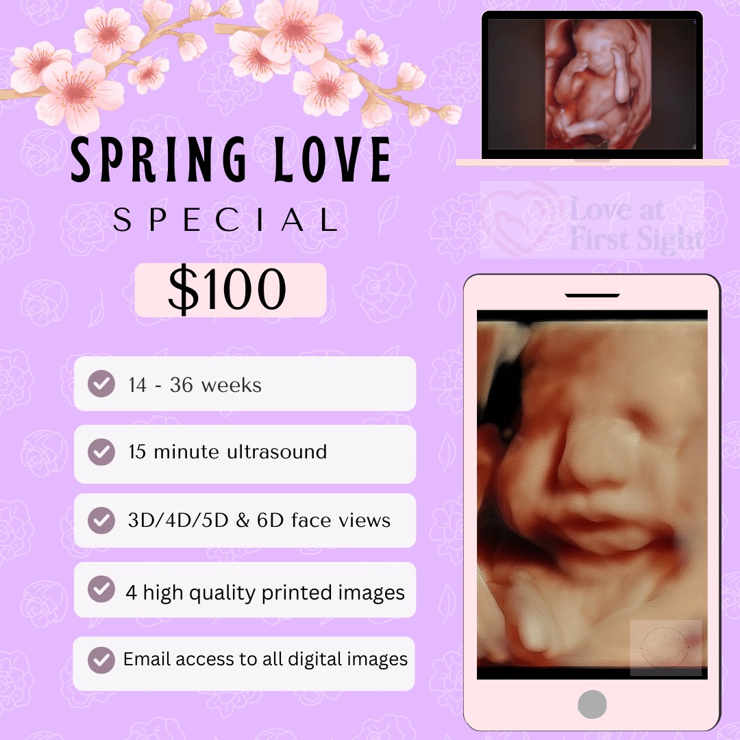 Spring Love Special from Love at First Sight Ultrasound